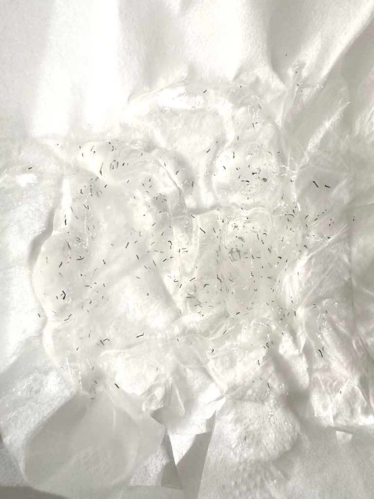 ヒゲ脱毛で抜けたヒゲ（ポップアップ現象）