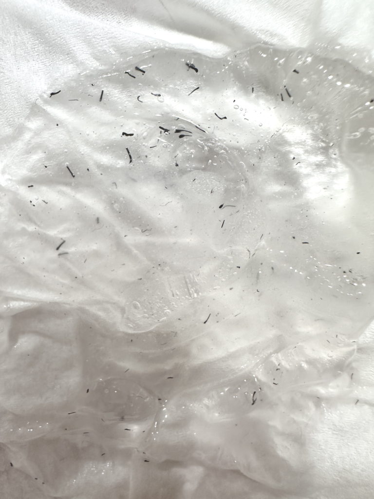 ヒゲ脱毛で抜けたヒゲ（ポップアップ現象）