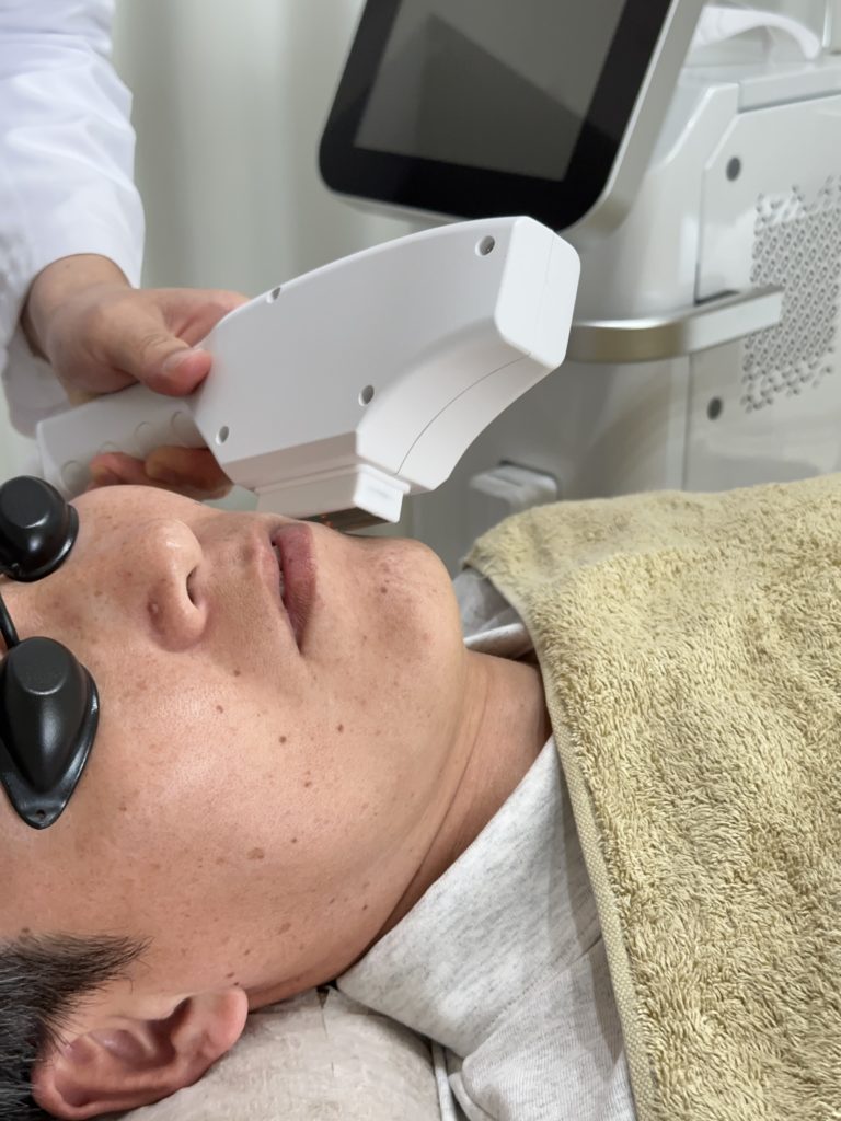 フォトフェイシャル